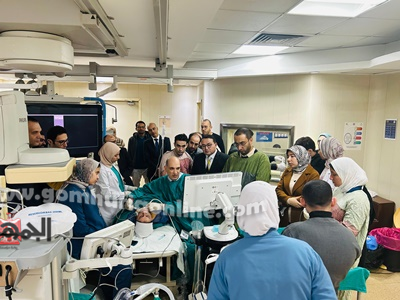 علاج أورام الغدة الدرقية بالكي الحراري في معهد الكبد بشبين الكوم