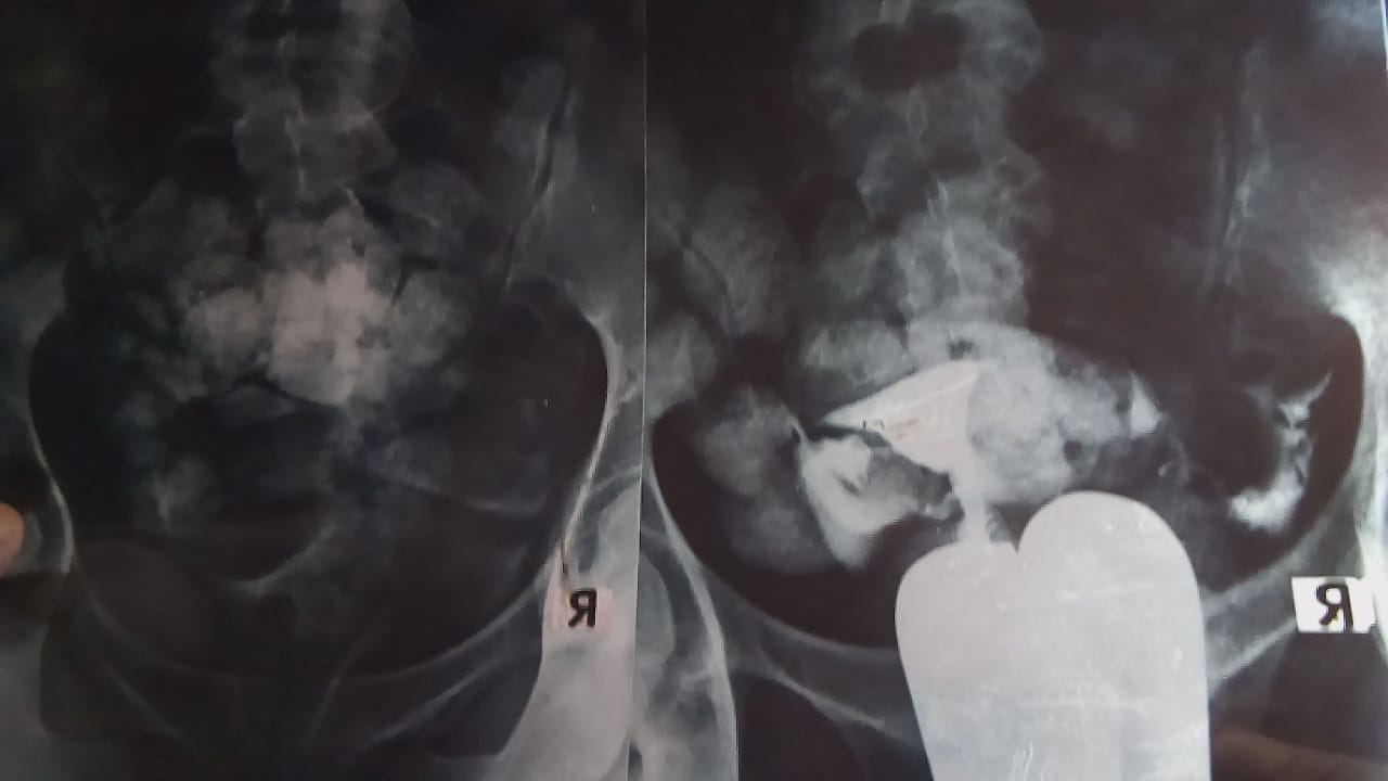 قمة الوجع مآساة حقيقية  لسنوات من الحرمان تعيشها أسرة فقيرة لم ترزق بأطفال بالوادى الجديد