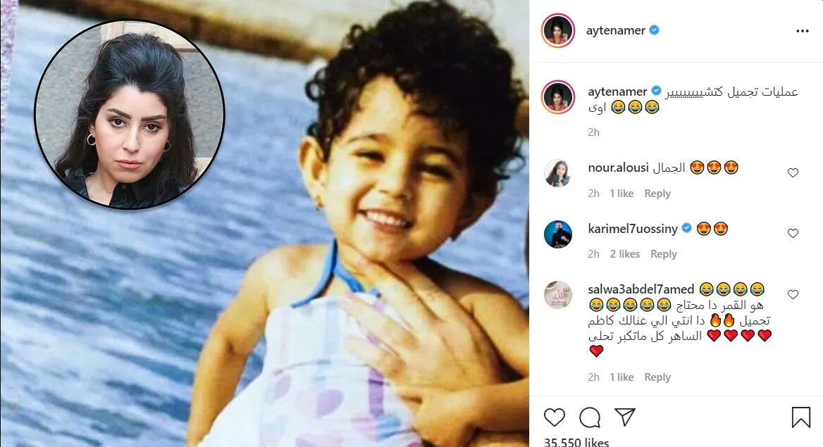 تعليق ساخر من ايتن عامر على انستجرام بشأن عمليات التجميل 