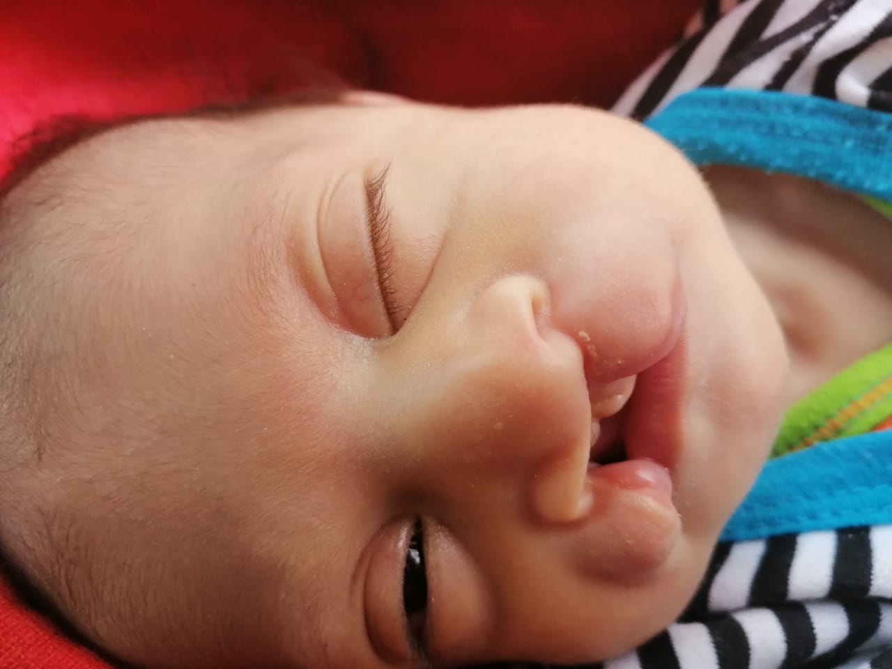 رضيعة الإسماعيلية تستغيث برئيس الوزراء لعلاجها  : شفة أرنبية وعيوب بالقلب وفقدان نصف الفك العلوي بعد تخلي والدها عنها  .