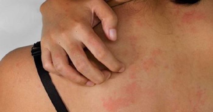 صورة تعبيرية