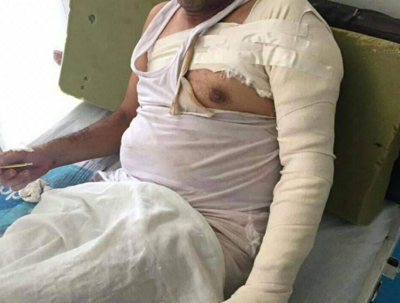 بعد حرق محام على يد خصومه بقضية بالشرقية.. الأجهزة الأمنية تنجح في القبض على الجناه