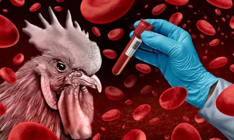 وقف تحول إنفلونزا الطيور إلى جائحة بشرية لايتعدى 48 ساعة 