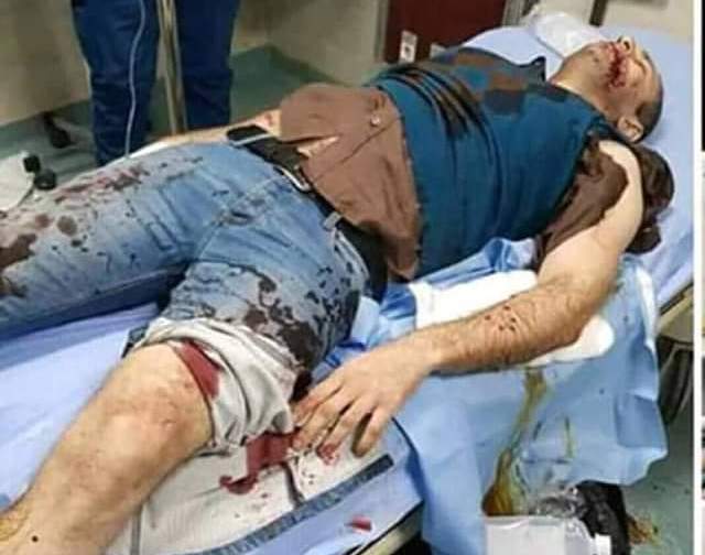 الضابط المصاب