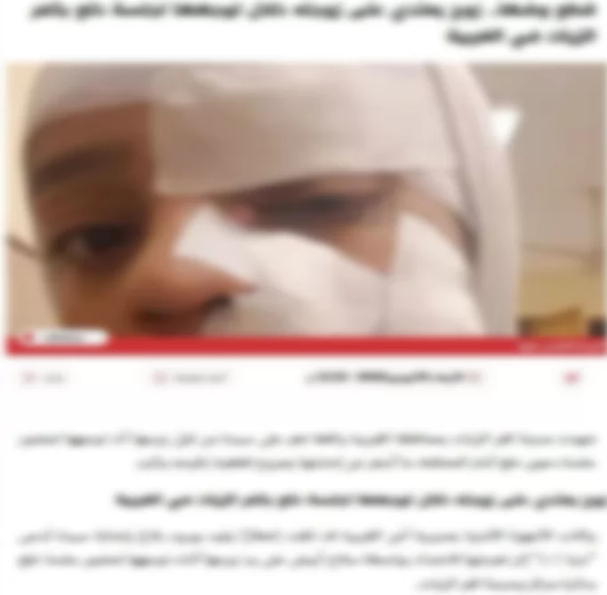 بسبب دعوى خلع.. ضبط عامل مزق جسد زوجته بسلاح أبيض في كفر الزيات