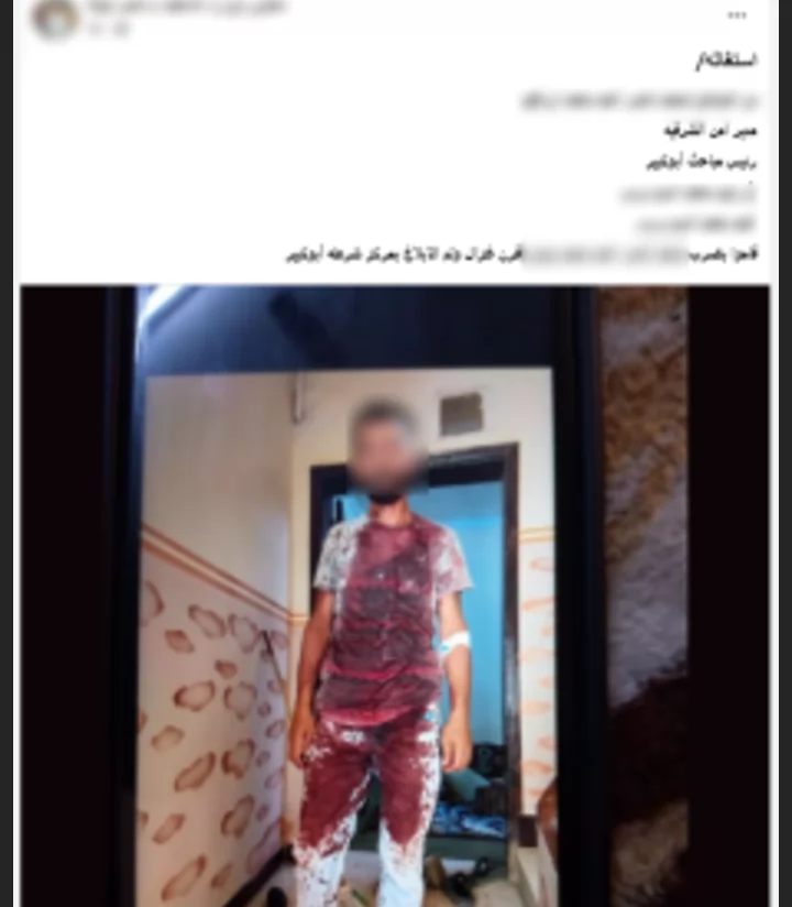 الأمن يضبط شقيقين تعديا على جارهما بالضرب في أبو كبير بالشرقية
