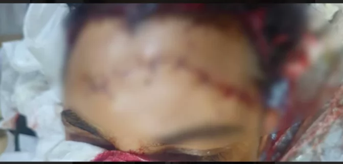 خلاف على «فرش السوق» وراء مشاجرة منوف.. وضبط مروج الأكاذيب