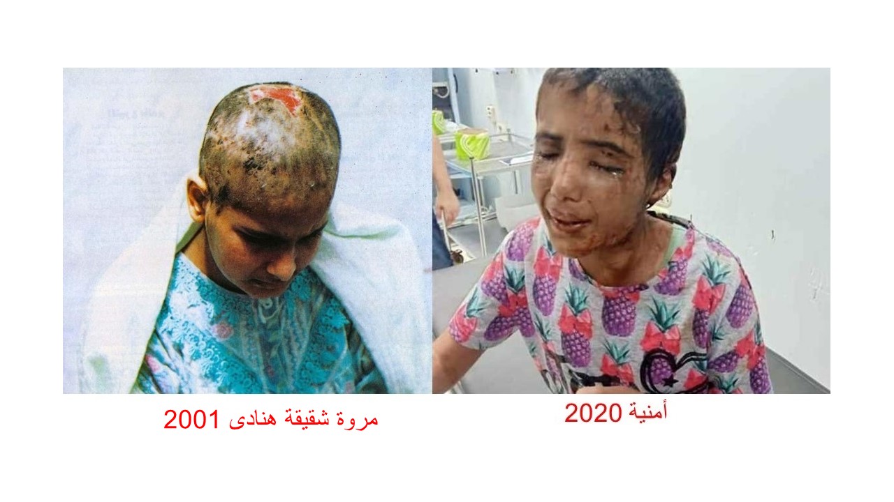 هنادى و أمنية .. تعذيب الخادمات مسلسل رعب لاينتهى