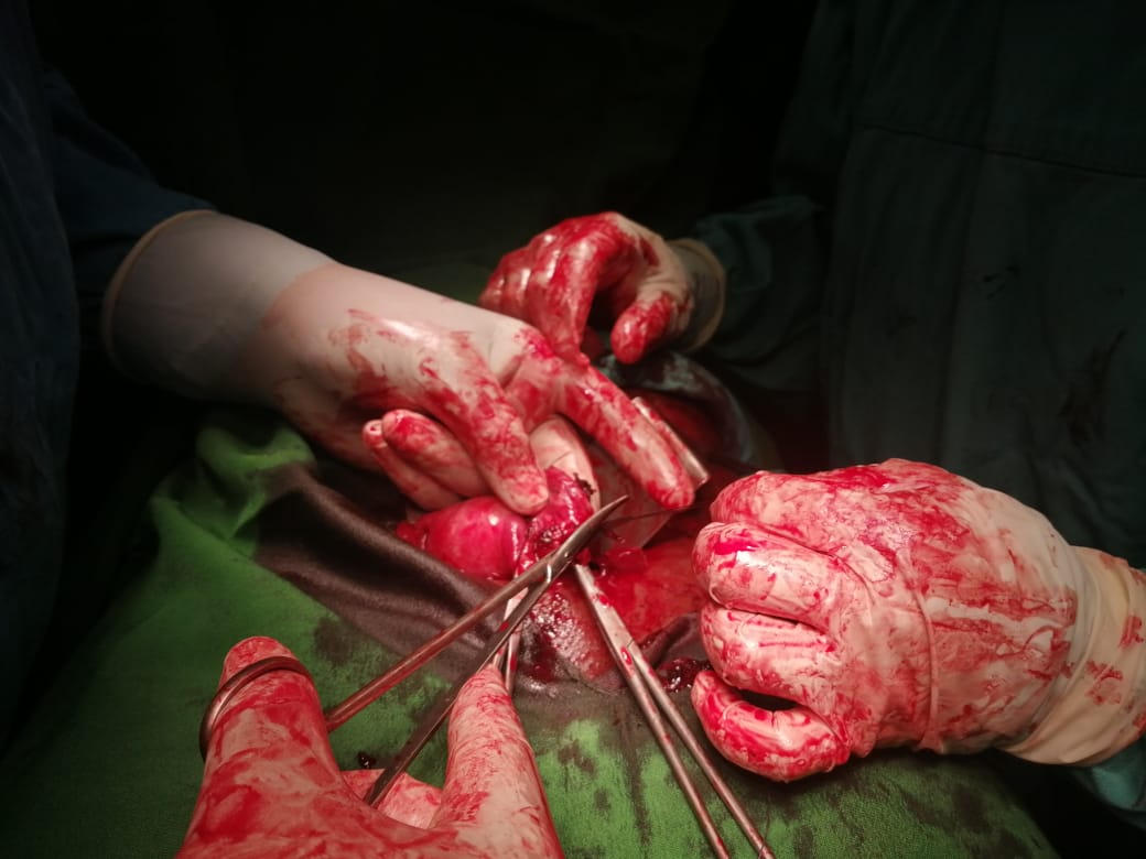 قافلة جامعة القاهرة في حلايب وشلاتين وأبو رماد تقدم خدماتها المجانية للمواطنين بالمناطق الحدودية