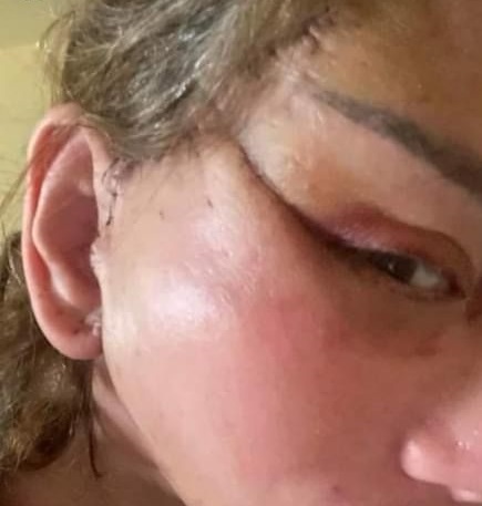 ريهام سعيد تريند بعد تشويه طبيب تجميل وجهها.. 