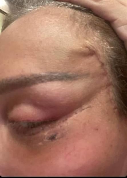 ريهام سعيد تريند بعد تشويه طبيب تجميل وجهها.. 