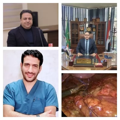 مستشفى قويسنا المركزي ينجح في أول جراحة منظار لإصلاح قرحة منفجرة بالاثني عشر