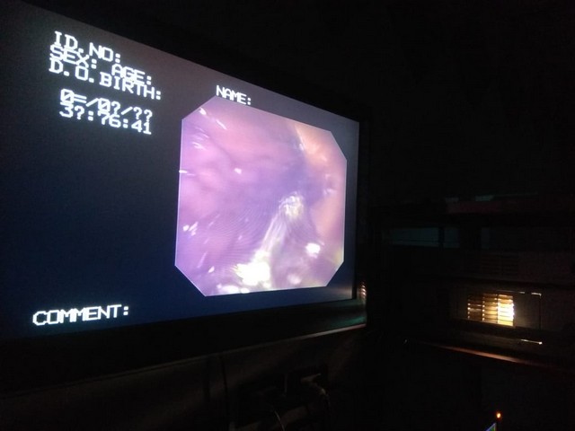 First slide