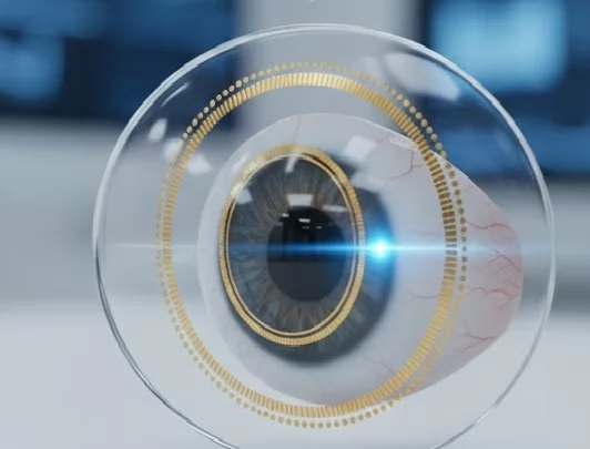 عدسة لاصقة ذكية -صورة تعبيرية بالذكاء الاصطناعي