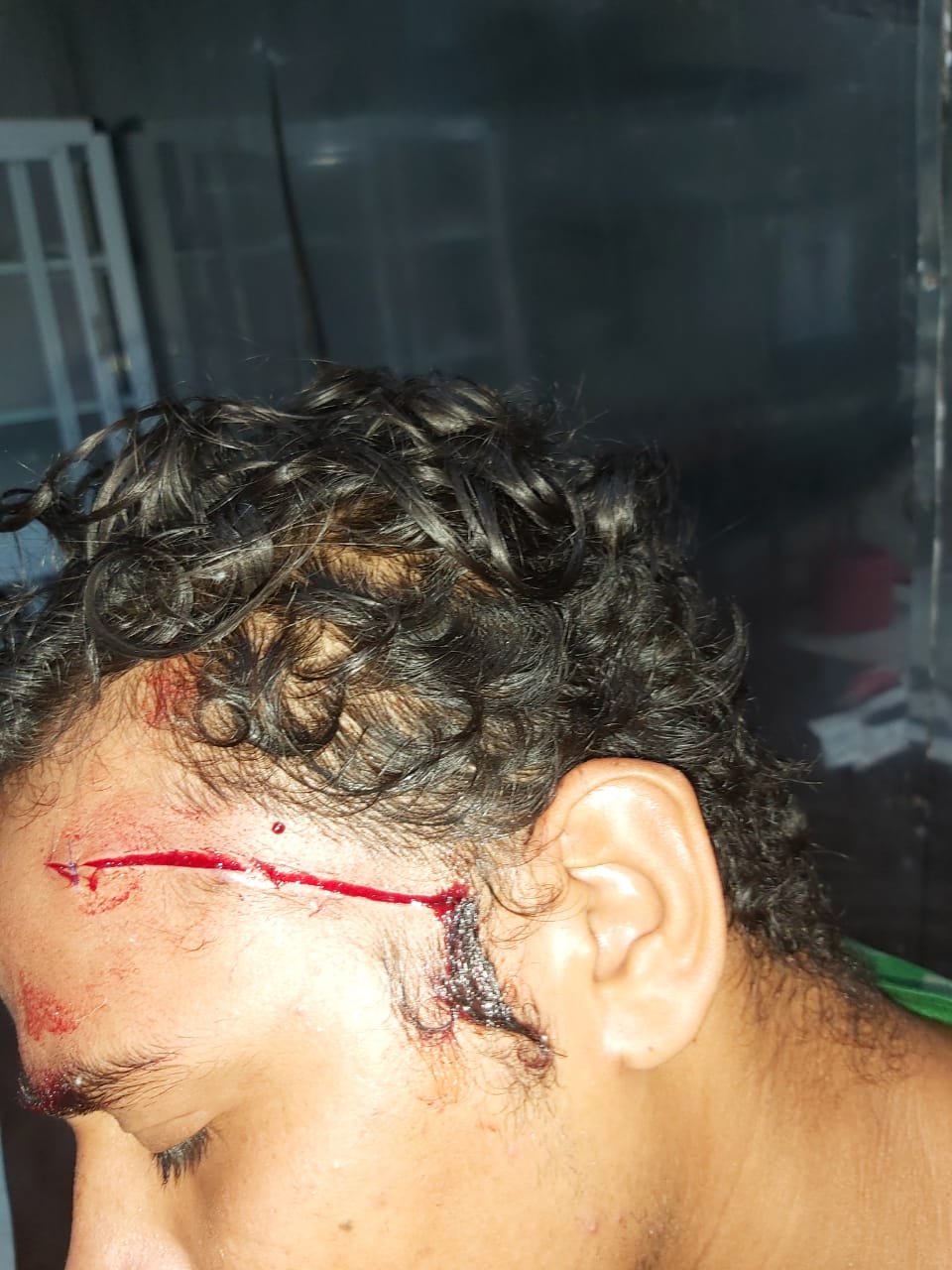 ثمن الشهامة ١٧ غرزة .شاب بالغردقة أنقذ فتاة من تحرش البلطجية فشوهو وجهه بالمطاوي.صور