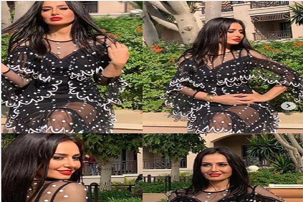 موجة انتقادات حادة لحلا شيحة بسبب تغيير ملامحها بعمليات التجميل والبوتكس.. صور 