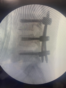 First slide