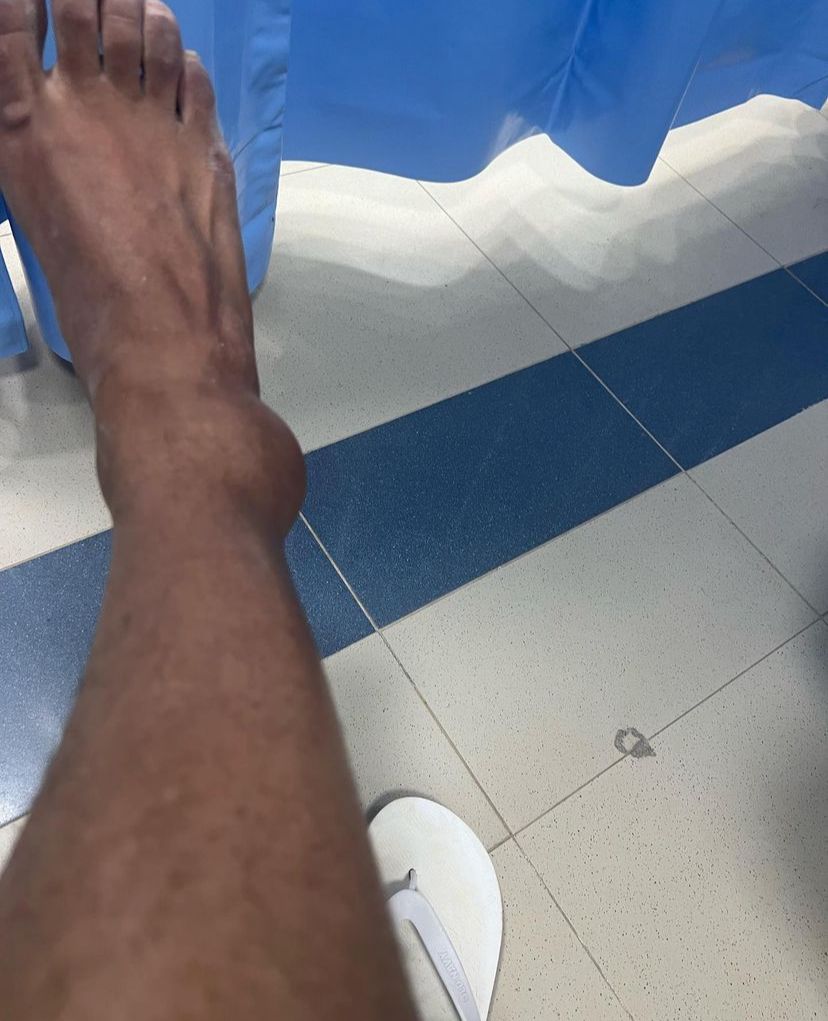 اصابة عمرو وهبة فى القدم.. صور