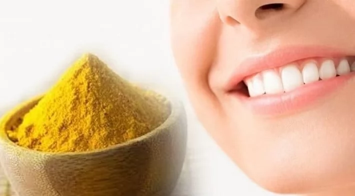 الكركمين .. أمل جديد لعلاج التهاب اللثة وتقوية صحة دواعم الأسنان 