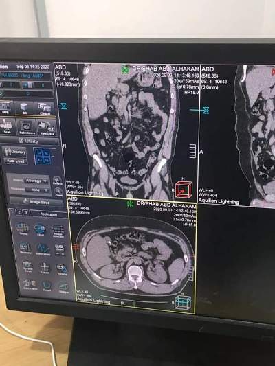 انشاء وتجهيز وحدة للسمعيات بتكلفة ٥ مليون جنيه بمستشفى القوصية المركزى 