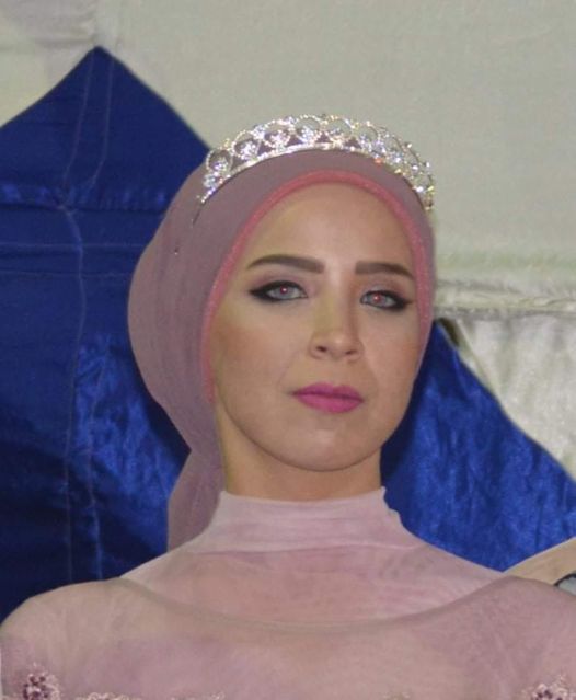 دينا الصهبى