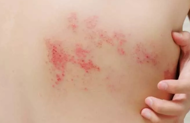 الحزام الناري