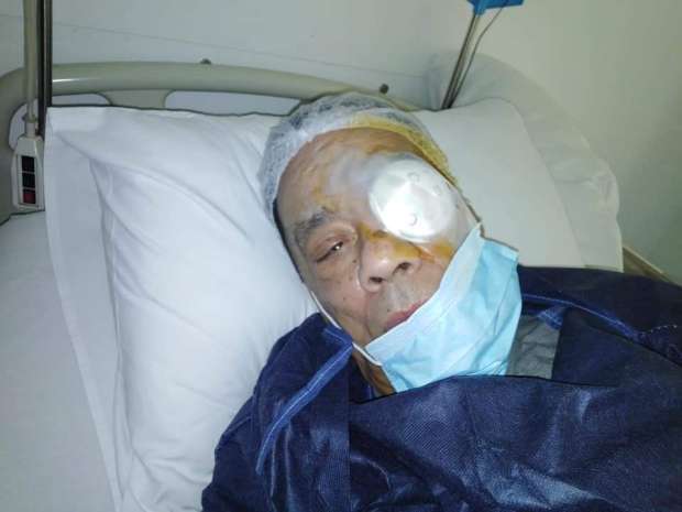 حلمي بكر للجمهورية أونلاين: غيرت العدسة فى عينى اليسرى وحالتى الصحية جيدة 