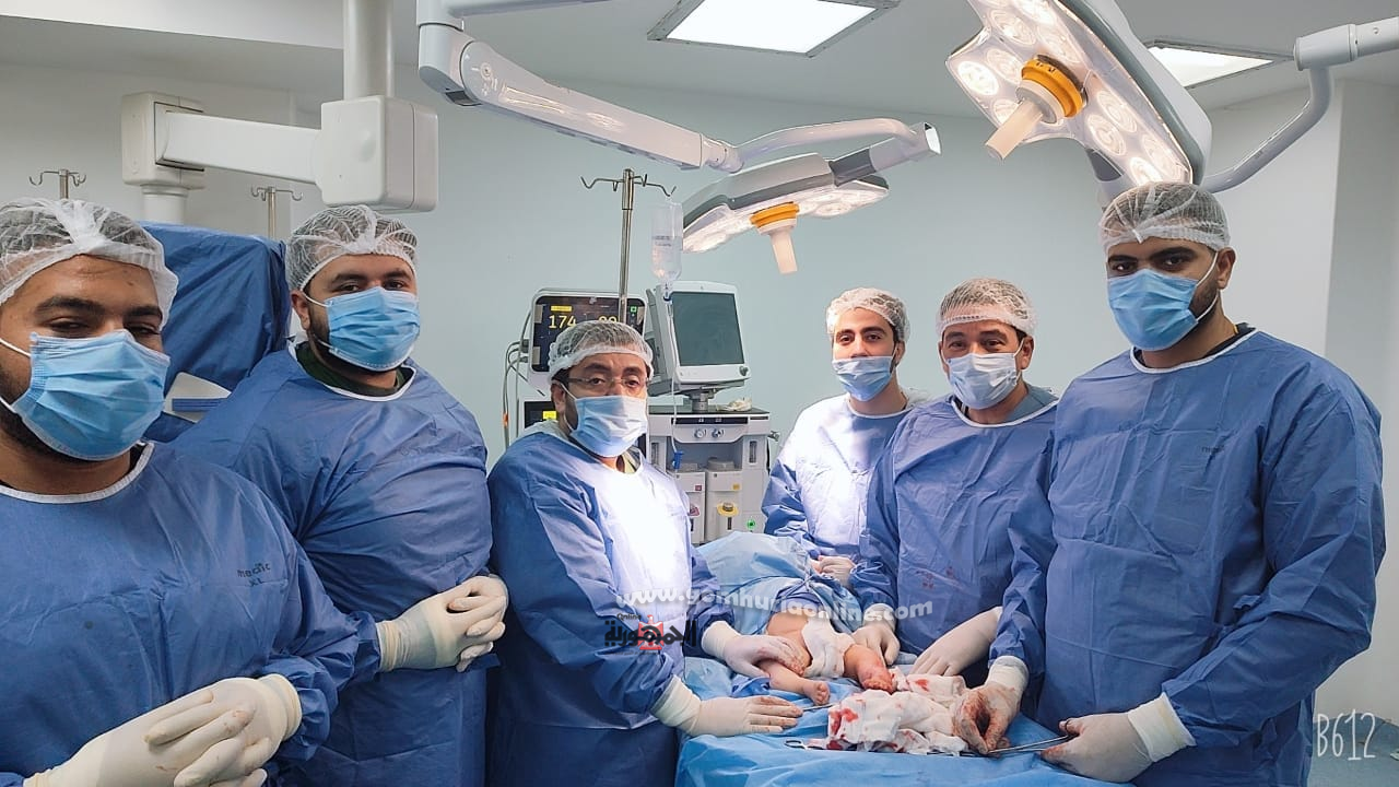 نجاح علاج تشوه وإعوجاج الساقين لطفل العظم الزجاجى بمستشفى شبين الكوم التعليمى