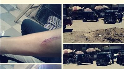 صحفى يحرر محضرا بتعدى بعض الجائلين على نجله واصابوه بجرجا