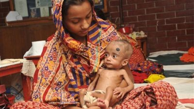 تعرف على أفضل الأكلات لمن يعانون من سوء التغذية