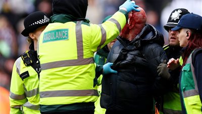 بالصور.. أحداث دموية في مدرجات إحدى مباريات كأس الاتحاد الأنجليزي