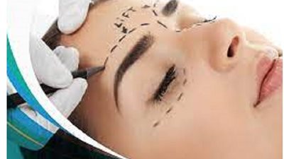 عمليات تجميل رفع الحواجب لاجل ازالة اثار الشيخوخة