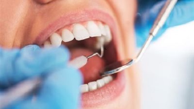 طبيبة: عدم علاج تسوس الأسنان يؤدي إلى عواقب وخيمة للصحة