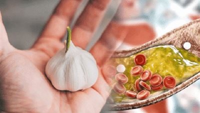 أكلات تقلل الكوليسترول والدهون الثلاثية أهمها .. الثوم والسمك
