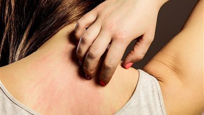 تعرف على اهم اسباب حساسية الطعام