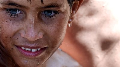 دراسة تكشف سبب الإصابة بمرض التوحد