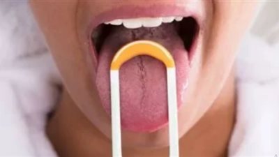 احذر هذه التغيرات في لون فمك .. تشير إلى مرض خطير