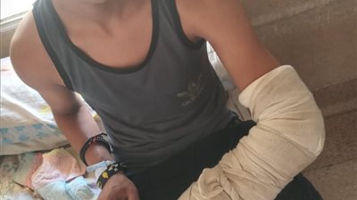 بعد اسبوعين من الانتظار عادل يدخل العمليات