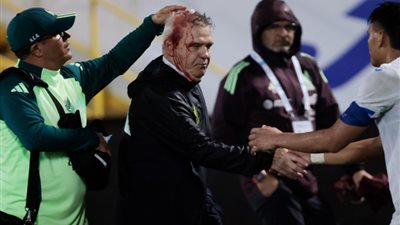 الاتحاد الأمريكي لكرة القدم يعاقب هندوراس بسبب أجيري