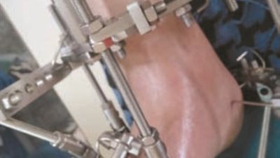 رحلة علاجه لم تنته