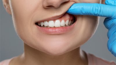 طرق فعالة للتخلص من آلام الضروس