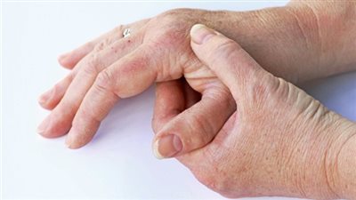 7 أعراض تخبرك أن جسمك في خطر منها اصفرار الجلد والهالات السوداء