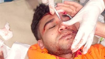 لهو الشباب بالزجاجات والصواريخ أصاب طالب جامعى بالغردقة