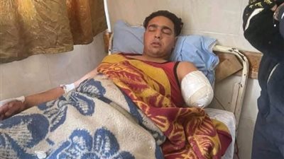 تفاصيل صادمة من شهود العيان بعد بتر ذراع العامل في سيرك طنطا