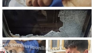 ألقوا الحجارة على القطار في المنوفية.. فأصابوا طفلة من ذوي الهمم