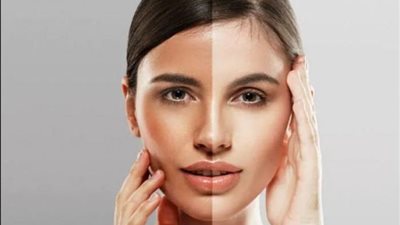 طرق طبيعية لتبييض البشرة