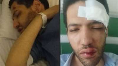 تفاصيل 