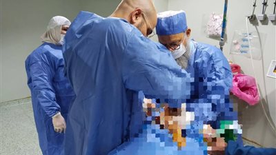 ٣ جراحات بمستشفى الفشن بأحدث جهاز لعمليات العظام