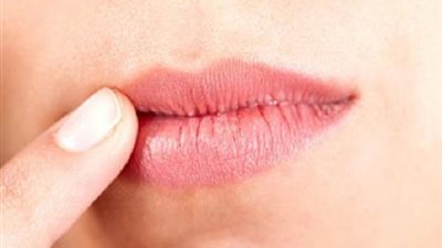 تشقق الشفاه .. مؤشر جمالي أم إنذار صحي؟
