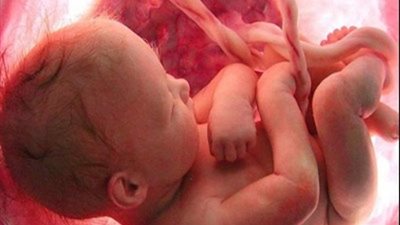 العثور على 2200 جنين في منزل طبيب عقب وفاته